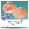 Biodermis-Xeragel Scar Gel